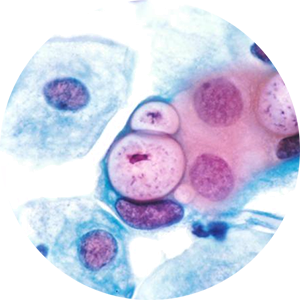 CHLAMIDIA TRACHOMATIS (HLAMIDIOZE)