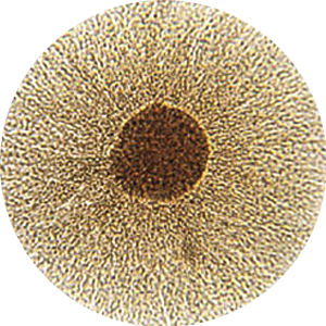 (MYCOPLASMA HOMINIS (MIKOPLAZMOZE)