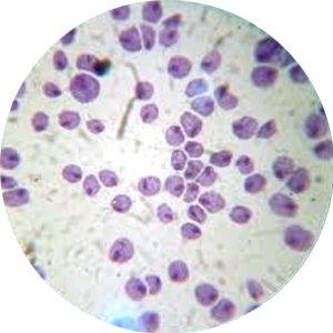 TRICHOMONAS VAGINALIS (TRIHOMONIĀZE)