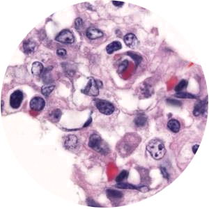 UREAPLASMA PARVUM (UREAPLASMA INFEKCIJA)