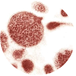 UREAPLASMA UREALITICUM (UREAPLAZMOZE)